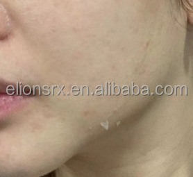 Correcteur de pigmentation Vin A Anti-âge bouton d'acné réduire la peau blanchissant crème de peeling jaune - Product Image 4