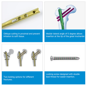 Femoral İntramedüller Çivi Titanyum Alaşımlı Kalça Kırığı Fiksasyon Sistemi CE ISO Sertifikalı - Product Image 2