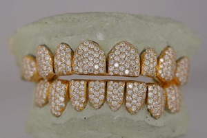 Grillz de Moissanita de Calidad Premium, Hechos a Medida, con Brillo Intenso y Diseño Seguro, Disponibles al Mejor Precio del Mercado - Product Image 5