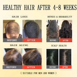 Pâte d'huile de Batana 118g Hommes et Femmes Huile de Batana pour la croissance des cheveux Prévention des pointes fourchues Repousse des cheveux Huile pour tous types de cheveux - Product Image 4