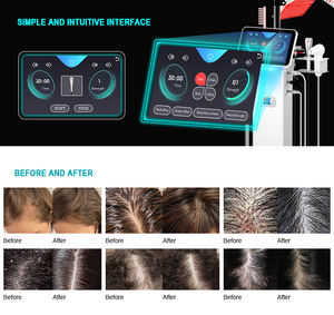 Analyseur de cuir chevelu professionnel et appareil de traitement 7 en 1 pour les soins capillaires avec massage et conseils sur les produits - Product Image 6