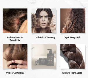 SMiB Herbal Anti Hair Loss Anti-Dandruff Volumizer <b>Shampoo</b> Niacinamide Salicylic Acid Scalp Care Vegan Sulfate Free - Product Image 5