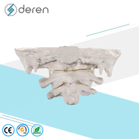 Modelo de Articulación Atlantoaxial Humana DRS1089, Modelo de Anatomía de Vértebras Cervicales para Entrenamiento