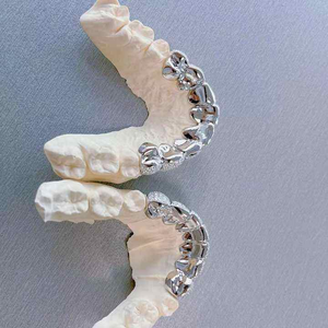 Grillz Diamantés de Qualité Supérieure, Capuchons Dentaires Personnalisés, Bijoux de Mode Urbaine Hip Hop de Luxe pour Hommes et Femmes - Product Image 1