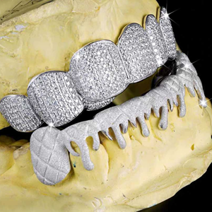 Joyería Hip Hop: Grillz de Dientes de Lujo Personalizados, Chapados en Oro, de Plata de Ley 925, con Moissanita y Estilo Iced Out, Mejor Precio - Product Image 6