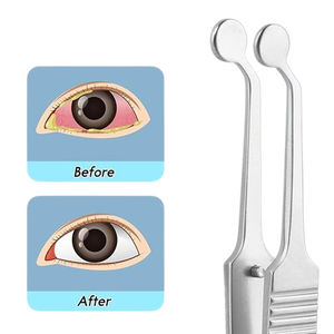 Pinzas Expressor para Glándulas de Meibomio, Pinzas para Párpados con Ojo Seco, Instrumentos Quirúrgicos Oftálmicos, Aprobadas por ISO - Product Image 5