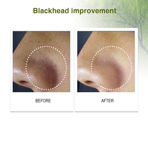 15% S acide Peeling sérum visage Anti-acné pores rétrécissement revitalisant Anti-âge tête noire dissolvant blanchissant corps utilisation - Product Image 5