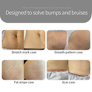 Ensemble de trois pièces de réparation de restauration de l'ADN OEM <span class=keywords><strong>camouflage</strong></span> de la peau de pigmentation de la peau pour l'élimination des vergetures - Product Image 5