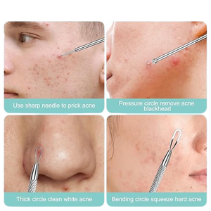 เครื่องมือกำจัดสิวเสี้ยนคุณภาพสูงระดับมืออาชีพ พร้อมอุปกรณ์ดูแลผิวหน้าและเครื่องมือกำจัดสิว - Product Image 4