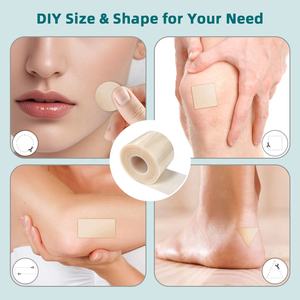 ม้วนผ้าพันแผลไฮโดรคอลลอยด์รักษาแผลขั้นสูงที่ดีที่สุด - Product Image 5