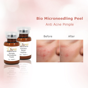 Suero Reafirmante de Piel con Espículas de Esponja, Corrector de Pigmentación Facial, Ampolla Reparadora con Aloe Vera y Ácido Hialurónico, Marca Privada - Product Image 4