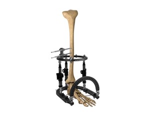 Instrumentos Médicos, Sistema de Retractores Quirúrgicos, Kit de Examen Vaginal, Acero Inoxidable Reutilizable de Alta Calidad, Manual - Product Image 3