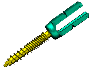 Vis de réduction polyaxiale et monoaxiale en alliage de titane pour chirurgie lombaire, prix usine - Product Image 2