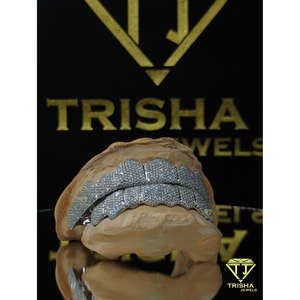 Grillz de luxe personnalisés sertis de diamants de laboratoire VVS, fabriqués en argent sterling 925, bijoux hip-hop - par Trisha Jewels - Product Image 1