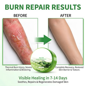 Gel d'<span class=keywords><strong>aloe</strong></span> <span class=keywords><strong>vera</strong></span> réparateur après-<span class=keywords><strong>soleil</strong></span> pour soulager les coups <span class=keywords><strong>de</strong></span> <span class=keywords><strong>soleil</strong></span> et apaiser les brûlures mineures - Product Image 6