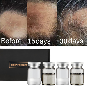 Tónicos para el Crecimiento del Cabello de Alta Potencia Más Vendidos, Cuidado del Cuero Cabelludo, Tratamiento para la Alopecia, Venta al Por Mayor - Product Image 1