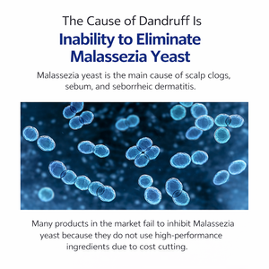 Korean Scalp Care Shampoo Probiotic Anti Dandruff Deep Cleansing Sebum Control Moisturizing Hair Strengthening Concentrated - Product Image 2