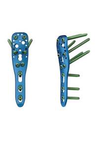 Plaques de blocage de sécurité pour humérus proximal de 3,5 mm, approuvées CE, les meilleures implants orthopédiques (2 pièces) avec 40 vis de blocage - Product Image 2