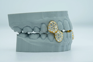 Custom 925 plata esterlina D VVS Moissanite dientes Grillz 2 Top 2 Bottom IGI certificado chapado en oro compromiso regalo de boda - Product Image 4