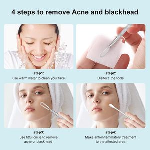 11cm High Carbon Steel Face Comedone <b>Extractor</b> Tool | Professional Double-Ended Acne & <b>Blackhead</b> Remover - Product Image 5