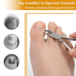 ที่ตัดเล็บมุมโค้ง 11 ซม. สำหรับเล็บขบที่นิ้วมือ/นิ้วเท้า ทำจากเหล็กกล้าคาร์บอนสูง ตรงคม แม่นยำ เหมาะสำหรับผู้ป่วยเบาหวาน ปากกว้าง - Product Image 3