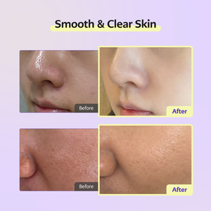 Sérum Ampoule Cellology Purple Carrot Pore 30ml |   Bakuchiol, acide hyaluronique, flavonoïdes d'origine végétale, anthocyanine, contrôle du sébum - Product Image 4