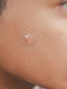 Parches Reusoul 2026 para Cubrir Imperfecciones, Acné y Espinillas, Parches Hidrocoloides para Curar, Saludables para Rostro y Cuerpo, Cubren Granos de Forma Invisible - Product Image 6