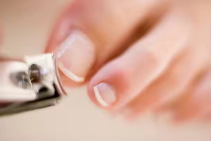 Coupe-ongles professionnel en acier inoxydable de haute qualité, 1 pièce, pour paronychie et ongles incarnés - Product Image 5
