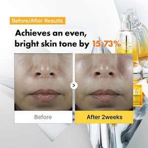 Ampolla Blanqueadora para Manchas Oscuras Apothe Exosome Mela-Glu 30ml, Suero Facial con Niacinamida de Uva, Cuidado de la Piel Coreano, Vida Útil de 3 Años - Product Image 3