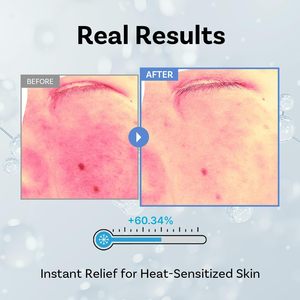 [APOTHE] Exo some SqualTox 3% Ampoule 30ml Renovación de la Piel, Iluminador, Antiarrugas, Antienvejecimiento, Cuidado Facial, Ceramida, Ácido Hialurónico - Product Image 3