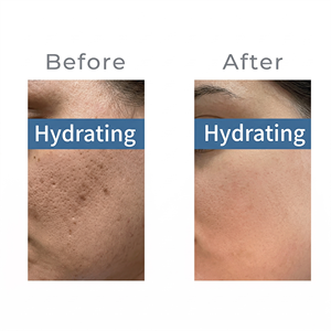 Sérum Hydratant Ultime Aribell Aqua Ampoule avec ADN de Saumon PN et Acide Hyaluronique pour Soins du Visage Professionnels et Lifting - Product Image 3