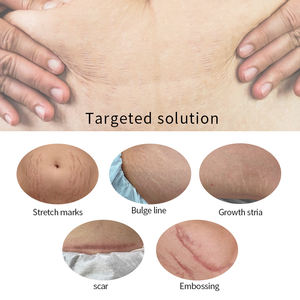 Ensemble de trois pièces de réparation de restauration de l'ADN OEM <span class=keywords><strong>camouflage</strong></span> de la peau de pigmentation de la peau pour l'élimination des vergetures - Product Image 2