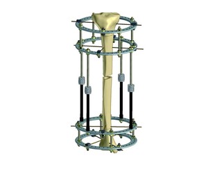 Instrumentos Médicos, Sistema de Retractores Quirúrgicos, Kit de Examen Vaginal, Acero Inoxidable Reutilizable de Alta Calidad, Manual - Product Image 1