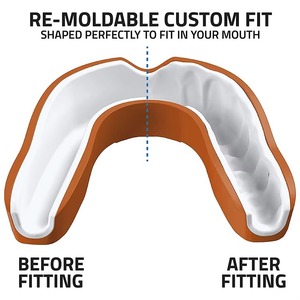 Protector Bucal de Boxeo para Adultos y Jóvenes, Duradero, Cómodo, Ecológico, de Silicona/Silica Fundida, Protector de Dientes, Protector de Encías, para Artes Marciales - Product Image 6