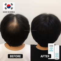 Ampul Penguat Rambut Antioksidan K Beauty SOD untuk Kulit Kepala yang Sehat dan Perawatan Akar yang Kuat