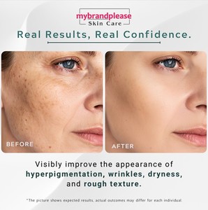 เซรั่มวิตามินซี 20% ไนอะซินาไมด์ สูตรเข้มข้นเพื่อผิวกระจ่างใส ชุ่มชื้น ลดสิว - Product Image 5