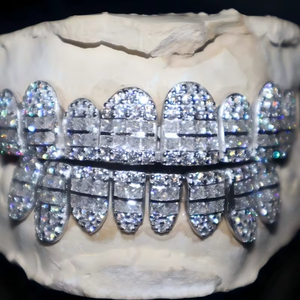 Grillz de luxe en argent 925 plaqué, sertis de moissanite de laboratoire taille brillant certifiée IGI, qualité VVS, style Hip Hop, bijoux dentaires - Product Image 3