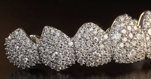 Grillz dentaire unisexe en argent sterling 925, synthétique HPHT CVD, avec mosaïque dentaire supérieure et inférieure, qualité VVS VS, pour un look raffiné - Product Image 5