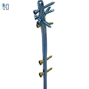 Système orthopédique de traumatologie : Clou tibial cannulé interverrouillable suprapatellaire - Product Image 4