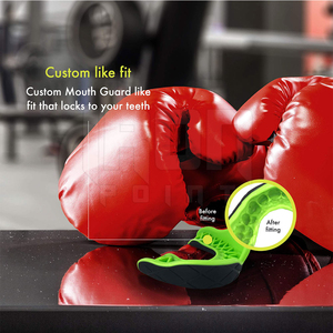 Protège-dents de boxe de qualité supérieure en EVA léger, doux, écologique et hautement élastique pour l'entraînement - Product Image 4