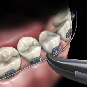 Ultra Slim Weingart Pliers Professional Orthodontic <b>Tool</b> <b>Safe</b> Effective Dental Appliance Instrument High Quality Precision Grip - Product Image 1