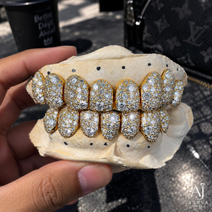 AARVA JEWELS Grillz dentaire personnalisé plaqué or 18 carats avec moissanite, ensemble complet amovible, style Hip Hop unisexe, certifié par une tierce partie - Product Image 4