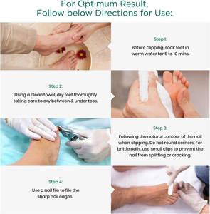 Kit d'instruments de podologie en acier inoxydable 4 pièces – Outils de podologue, coupe-ongles, lime noire, lime diamantée, dégrossisseur pour doigts/des orteils - Product Image 4