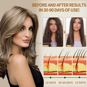Maschera per <span class=keywords><strong>Capelli</strong></span> Secchi alla Cheratina Biologica con Olio di Batana, <span class=keywords><strong>Balsamo</strong></span> e Crema per Uomini e Donne, Idratazione, Riparazione e Ricrescita, Etichetta Privata - Product Image 5