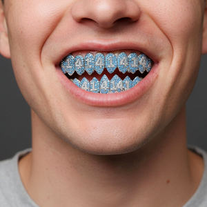 Grillz de Moissanita Personalizados en Plata de Ley 925, Joyería Dental Premium para Hombres y Mujeres, Estilo Urbano - Product Image 2