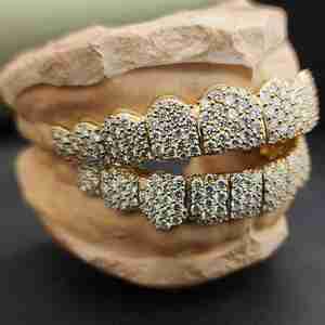 Juego de Grillz de Diamantes Personalizados DOPE JEWELLS, Chapado en Oro de Ley 925, Engaste Pavé, Joyería Hip Hop para Hombre, 10.78 CT - Product Image 3