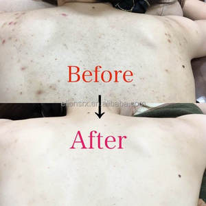Suero Avanzado con 30% de Ácido Prímico para Aclarar la Piel y Eliminar la Pigmentación Profunda, Suero Exfoliante con Ácido Prímico para el Cuidado de la Piel - Product Image 6