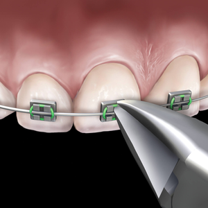 Micro-cutter orthodontique fin, instrument dentaire de précision en acier inoxydable, outil de coupe de fil, usage professionnel en clinique, durable - Product Image 1