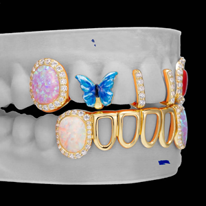 Grillz dentaire de luxe Hip Hop personnalisé en argent 925 plaqué or, serti de moissanite - Product Image 3