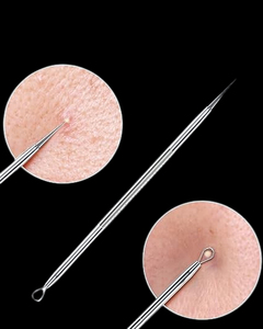 High Durability & Sustainable Pore Cleaner Face Acne <b>Extractor</b> Skin Care Tools <b>Blackhead</b> Remover Acne Remover Instrument - Product Image 3